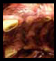 apotribidonti